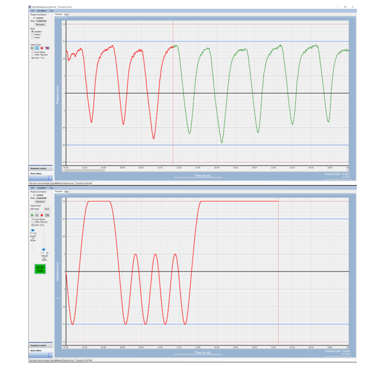 Modus QUASAR呼吸運動平臺