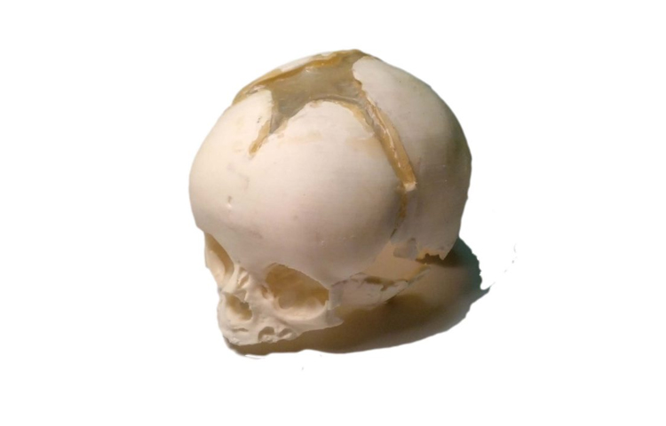 英國PI 新生兒頭骨模型