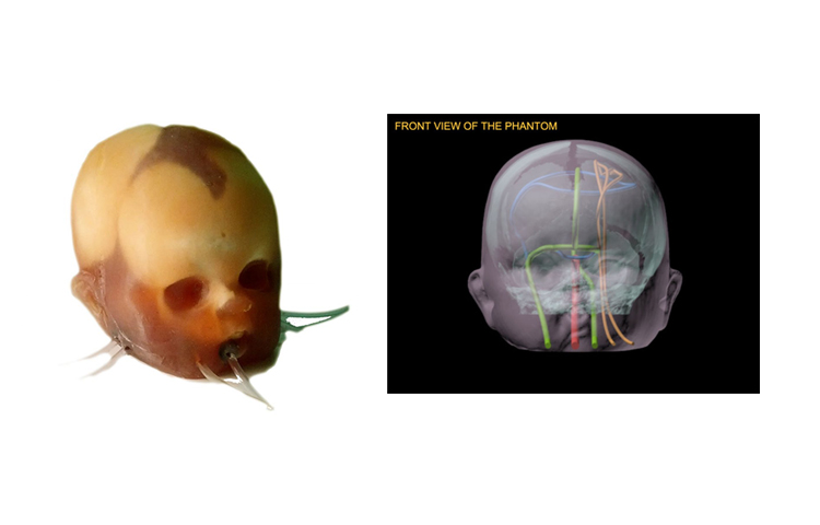 英國(guó)PI 新生兒頭部模體