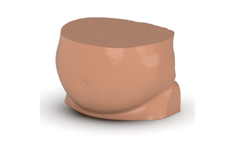 德國phantomx 53-05腹部主動脈瘤模體